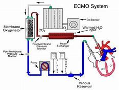 ECMO(体外膜肺氧合)心肺机工作原理